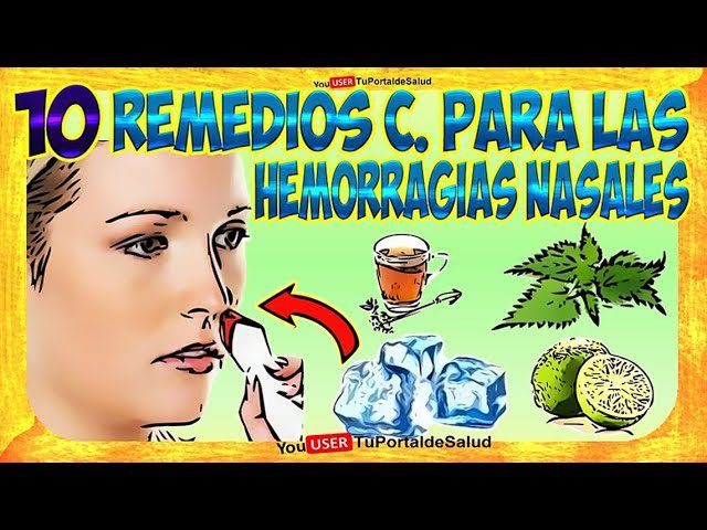 como-parar-la-sangre-de-la-nariz-remedios-caseros