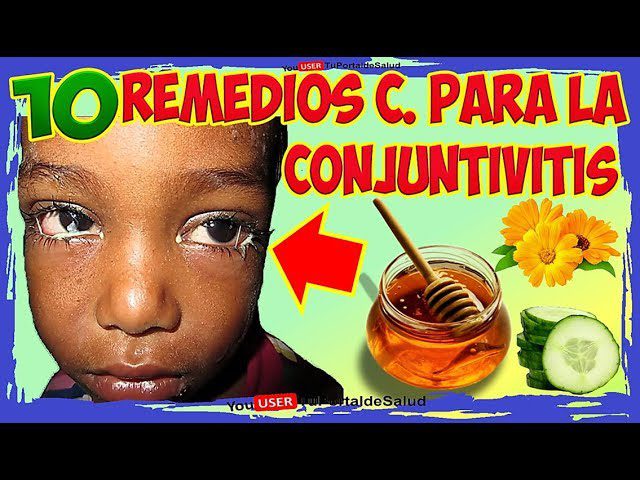 como-prevenir-la-conjuntivitis-remedios-caseros