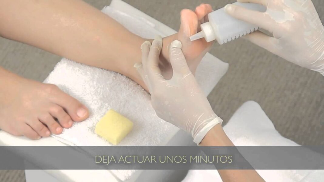 como-quitar-callosidades-de-los-pies