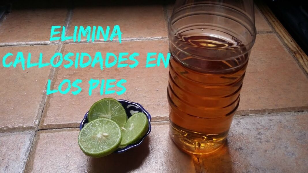 como-quitar-callosidades-de-los-pies-remedios-caseros