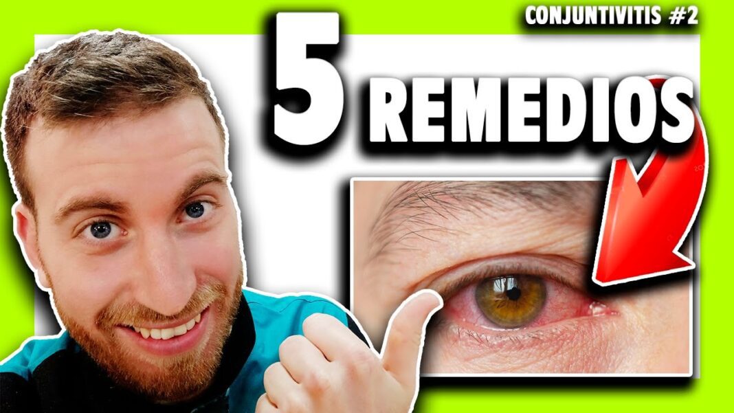 como-quitar-la-conjuntivitis-con-remedios-caseros