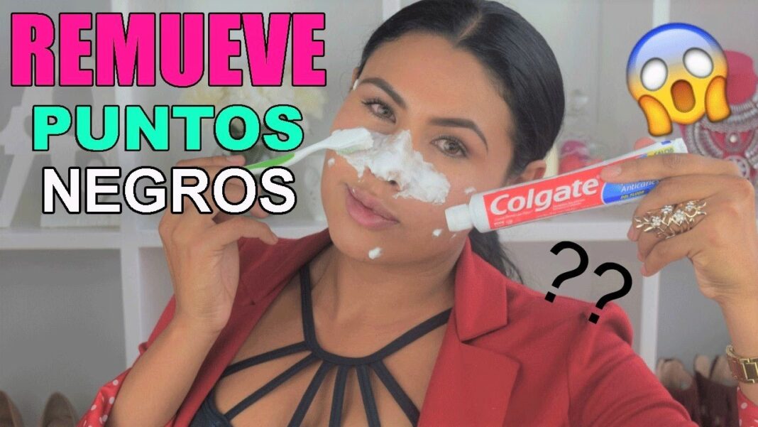 como-quitar-los-puntos-de-la-cara-remedios-caseros