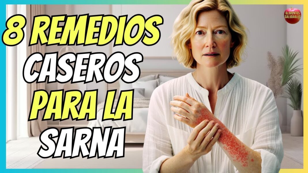 como-se-cura-la-sarna-en-humanos-remedios-caseros