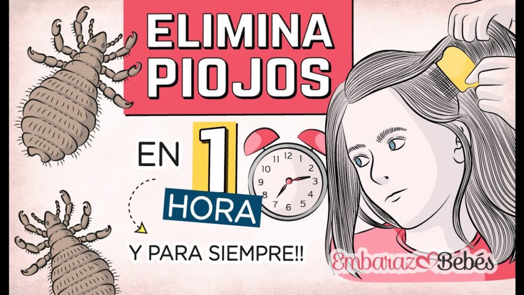 eliminar-piojos-remedio-casero