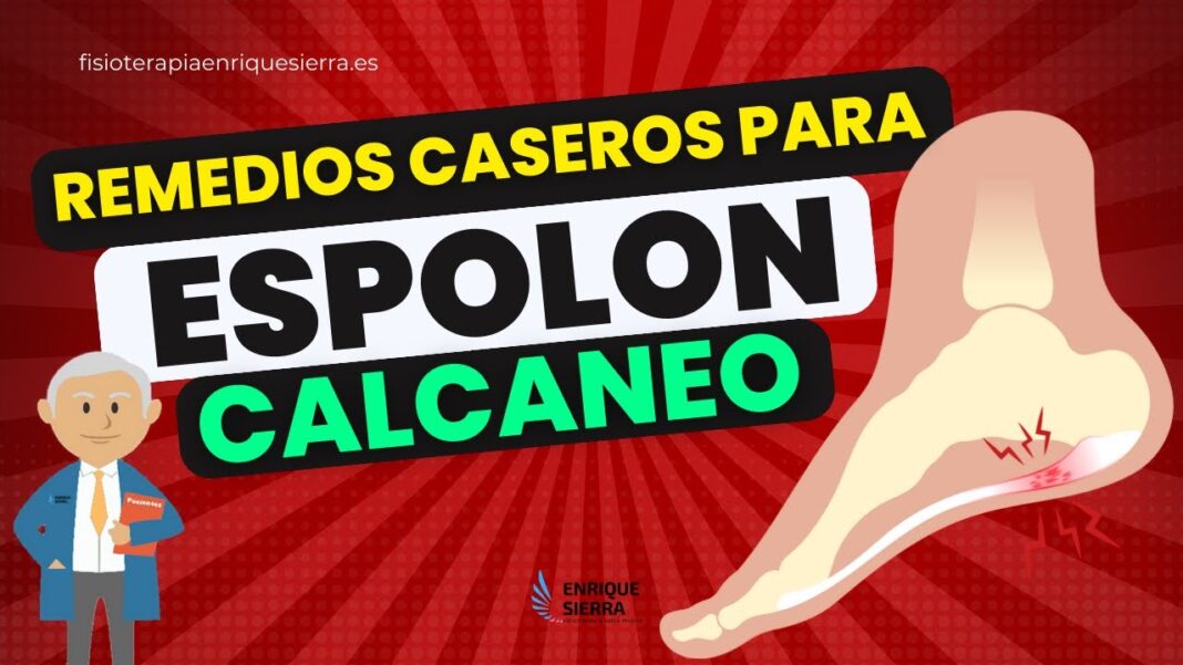 espolon-en-el-pie-remedios-caseros