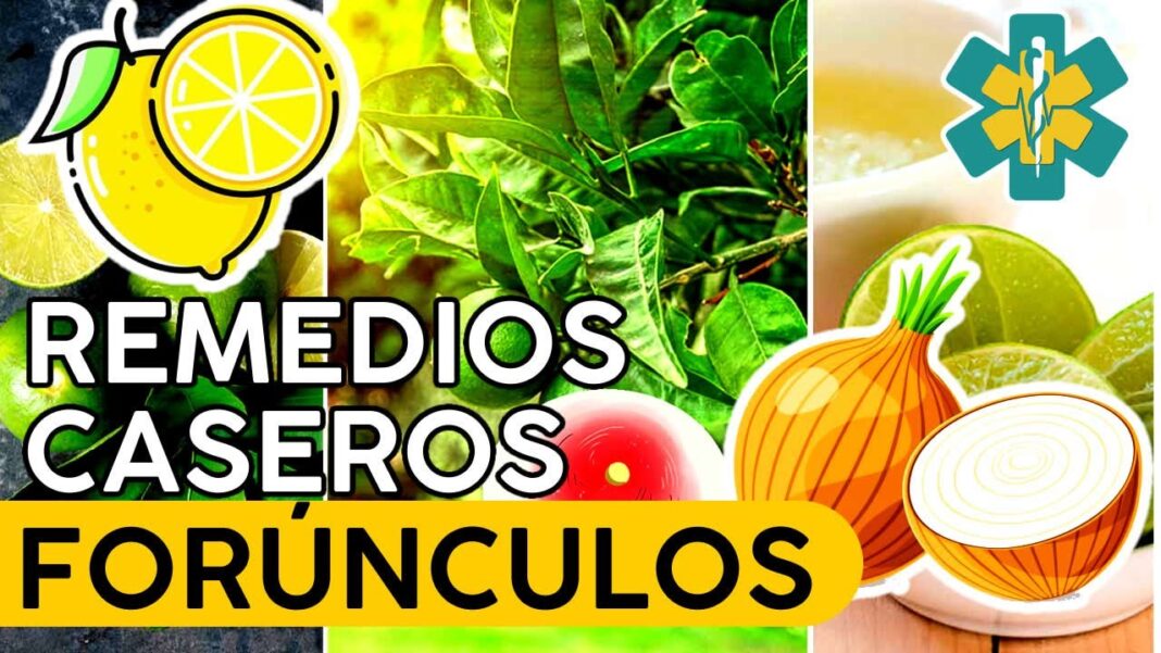 forunculos-en-las-axilas-remedios-caseros
