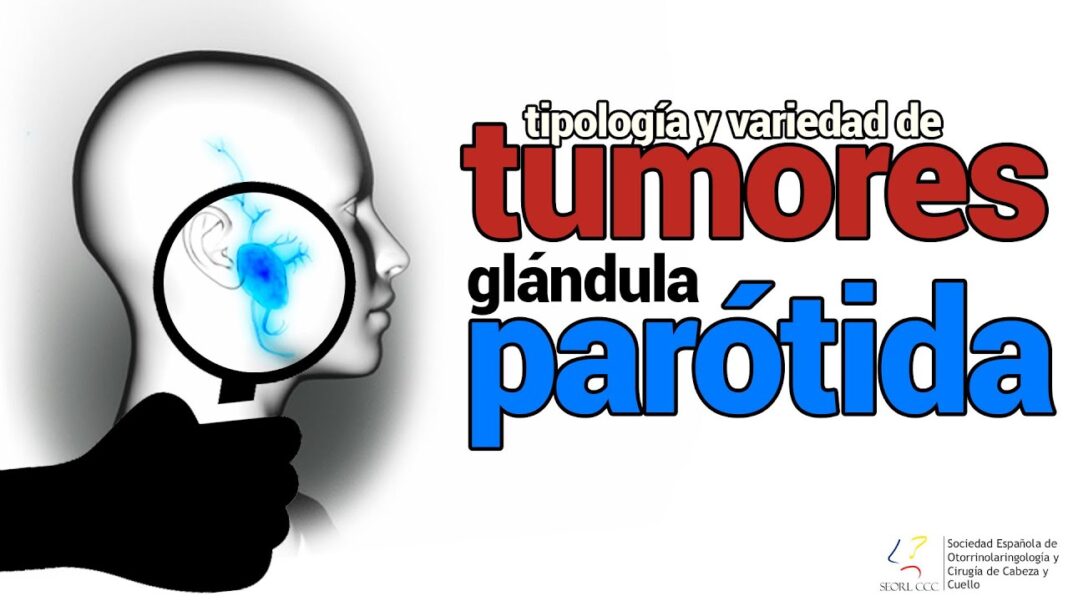 glandulas-salivales-inflamadas-remedios-caseros