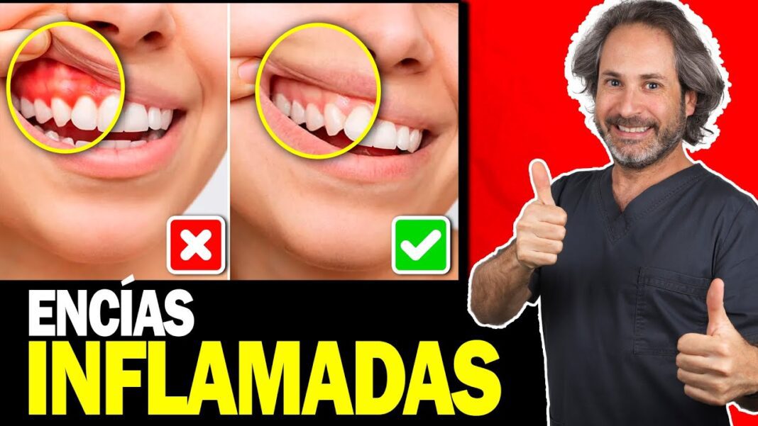 infeccion-en-las-encias-remedios-caseros