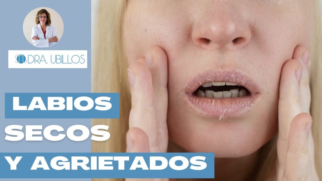 labios-resecos-remedios-caseros