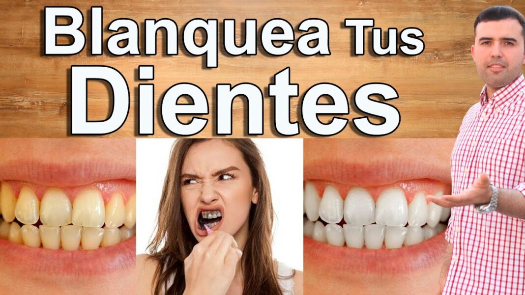 remedios-caseros-para-blanquear-los-dientes-en-un-dia