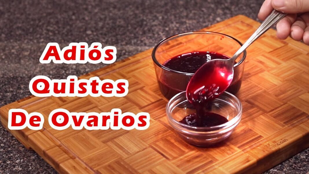 remedios-caseros-para-deshacer-los-quistes-en-los-ovarios