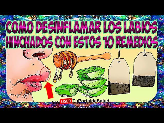 remedios-caseros-para-desinflamar-golpes-en-la-boca