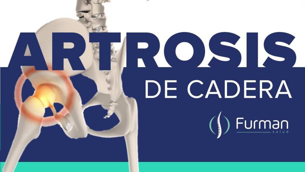remedios-caseros-para-el-dolor-de-cadera