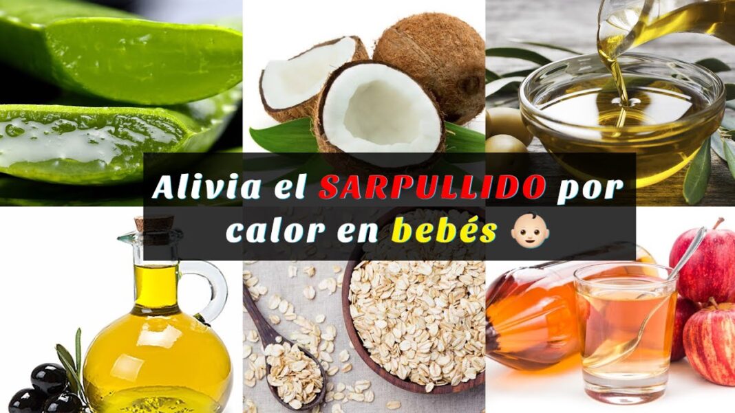 remedios-caseros-para-el-sarpullido-en-ninos
