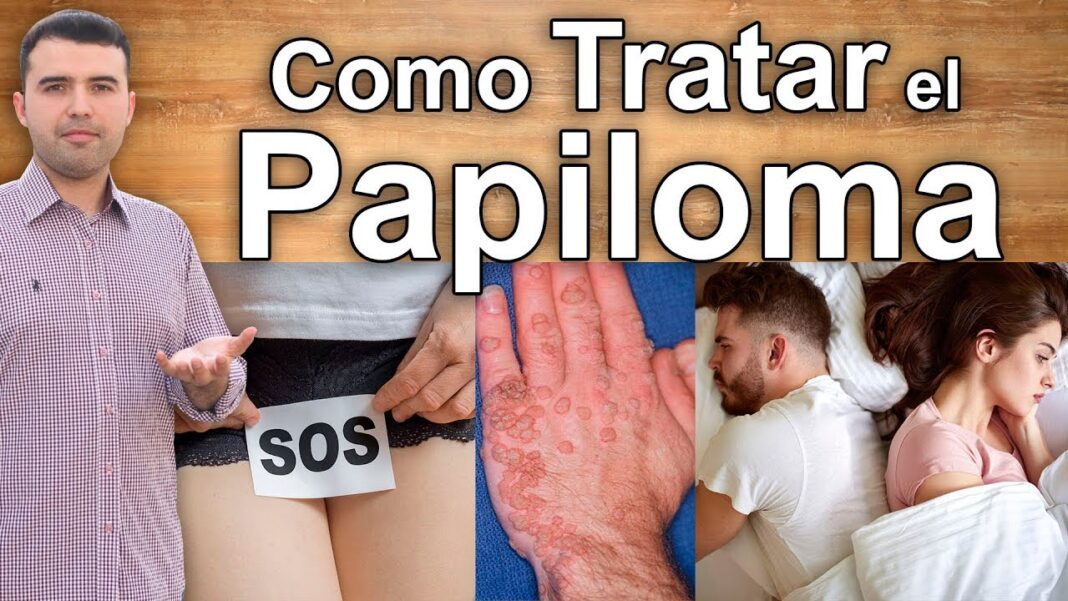 remedios-caseros-para-el-vph-en-la-garganta
