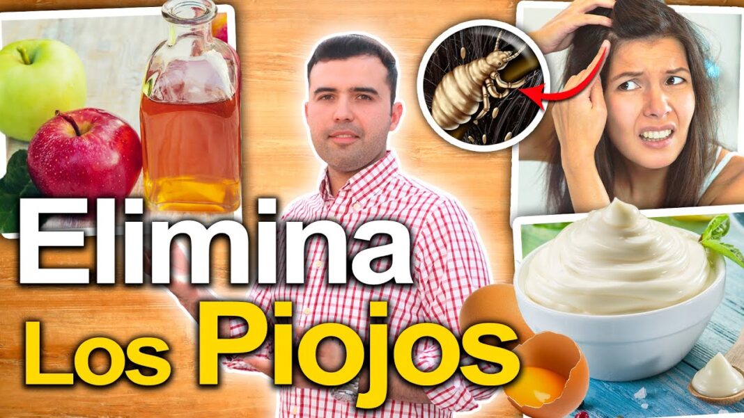 remedios-caseros-para-eliminar-piojos-y-liendres
