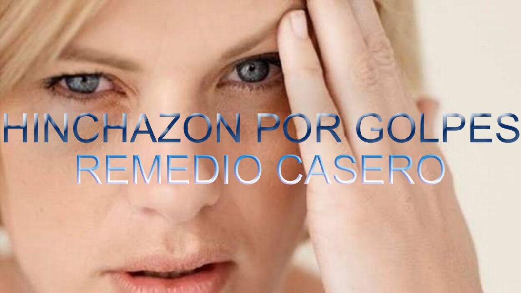 remedios-caseros-para-golpes-inflamados-en-la-cara