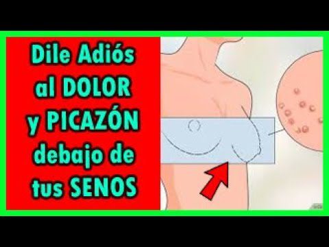 remedios-caseros-para-irritacion-debajo-de-los-senos