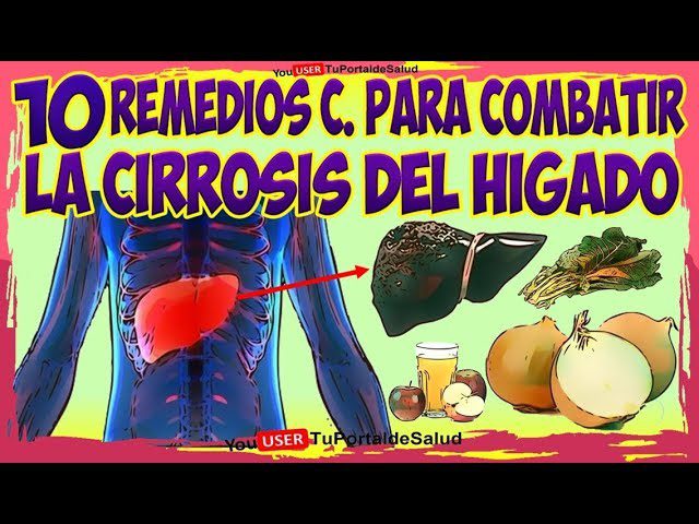 remedios-caseros-para-la-cirrosis