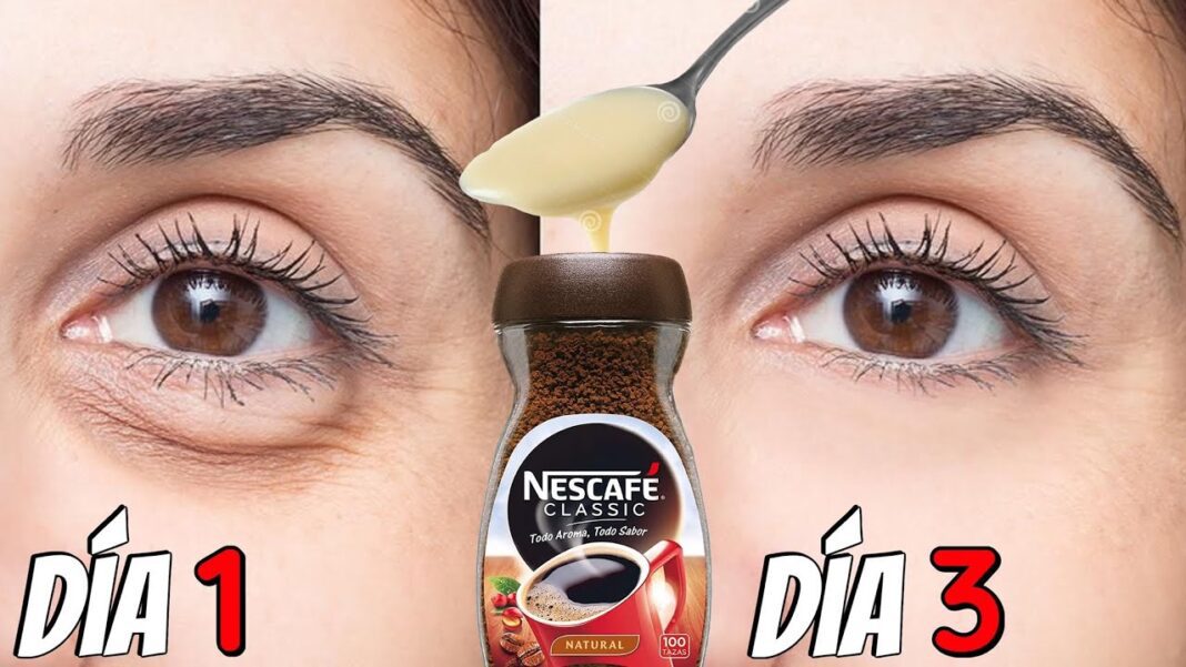 remedios-caseros-para-las-bolsas-de-los-ojos-1