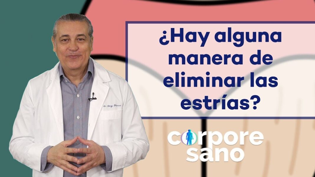 remedios-caseros-para-las-estrias-en-las-pompis