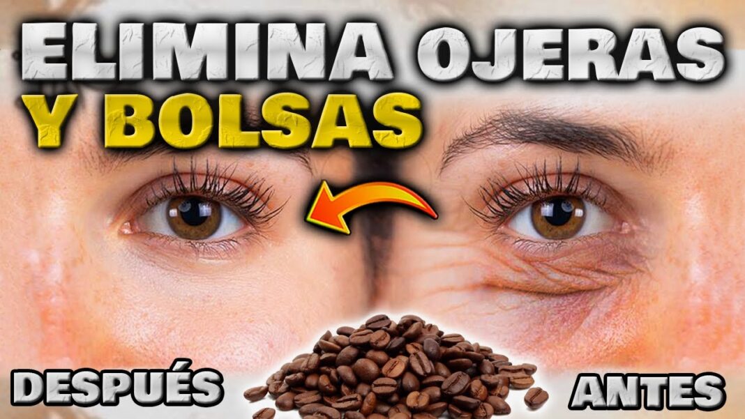 remedios-caseros-para-las-ojeras-negras