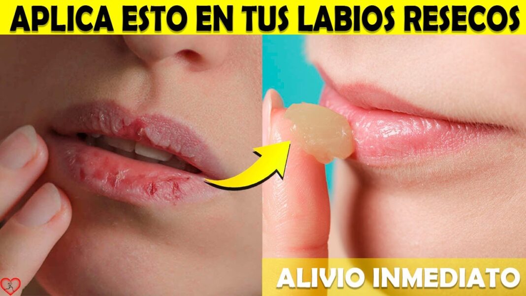remedios-caseros-para-los-labios-resecos