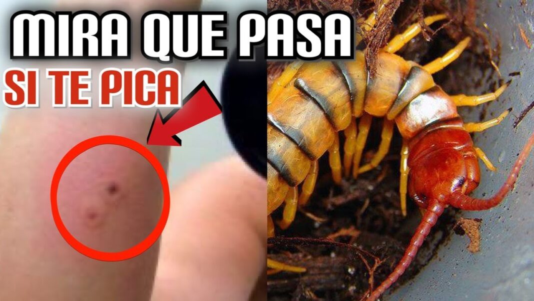 remedios-caseros-para-picadura-de-ciempies