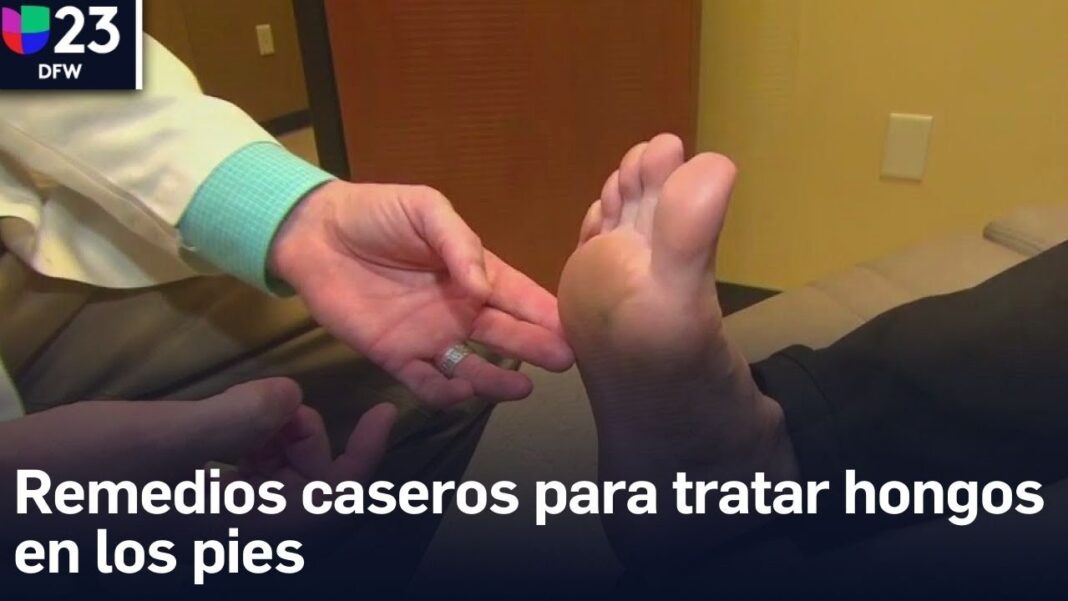 remedios-caseros-para-pies-agrietados-y-con-hongos