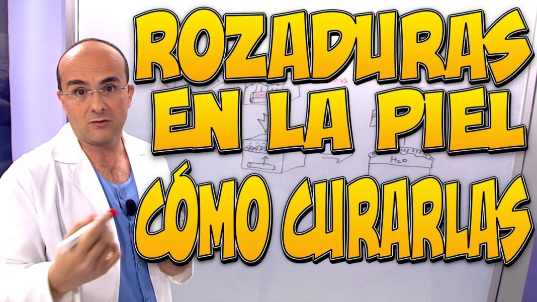 remedios-caseros-para-rozaduras-en-adultos