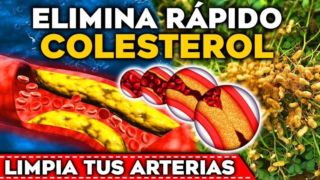 un-remedio-casero-para-el-colesterol
